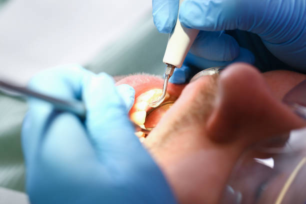 Best Broken or Cracked Tooth Emergency Dentist in Jerome, IL