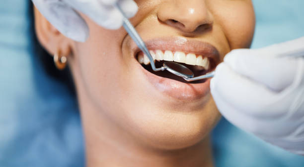 Best Emergency Dentist for Knocked-Out Tooth in Jerome, IL